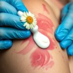 Arnika krém alkalmazása a zúzódás kezelésére kézben álló krémmel.