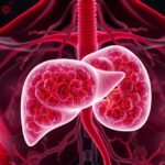 A lép és immunrendszer szerepe az egészség védelmében